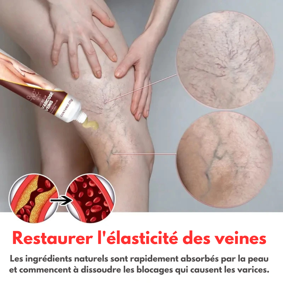 Crème Anti Varice Kanye™ : Restaure les veines endommagé✨