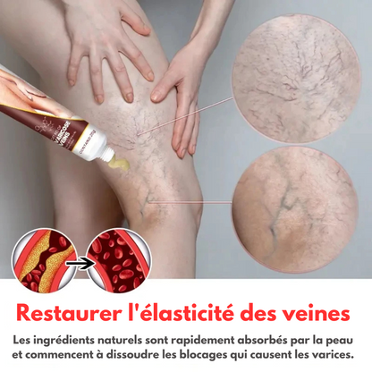 Crème Anti Varice Kanye™ : Restaure les veines endommagé✨